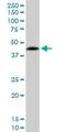 Protein Phosphatase 1 Regulatory Subunit 8 antibody, H00005511-M21, Novus Biologicals, Western Blot image 