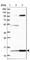 TRNA Methyltransferase Subunit 11-2 antibody, HPA039901, Atlas Antibodies, Western Blot image 