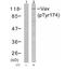 Vav Guanine Nucleotide Exchange Factor 1 antibody, orb14860, Biorbyt, Western Blot image 