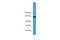 Asparagine Synthetase (Glutamine-Hydrolyzing) antibody, ARP60203_P050, Aviva Systems Biology, Western Blot image 