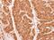 Proteasome 20S alpha 2 antibody, NBP1-31542, Novus Biologicals, Immunohistochemistry paraffin image 
