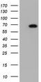 Adenylate Kinase 5 antibody, LS-C115581, Lifespan Biosciences, Western Blot image 