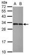 Inositol monophosphatase 1 antibody, GTX109616, GeneTex, Western Blot image 