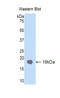 TIMP Metallopeptidase Inhibitor 1 antibody, LS-C296668, Lifespan Biosciences, Western Blot image 