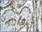 MutS Homolog 6 antibody, ab92471, Abcam, Immunohistochemistry paraffin image 