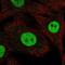 Ring Finger And WD Repeat Domain 3 antibody, NBP2-58819, Novus Biologicals, Immunofluorescence image 