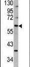 MDM2 Proto-Oncogene antibody, PA5-11352, Invitrogen Antibodies, Western Blot image 