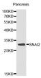 SNAI2 antibody, orb48975, Biorbyt, Western Blot image 