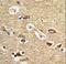 Mitochondrial import receptor subunit TOM70 antibody, LS-C160111, Lifespan Biosciences, Immunohistochemistry paraffin image 
