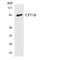 Carnitine Palmitoyltransferase 1C antibody, LS-C291830, Lifespan Biosciences, Western Blot image 