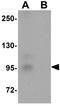 Probable ribonuclease ZC3H12C antibody, GTX85195, GeneTex, Western Blot image 