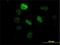 Splicing Factor 3b Subunit 2 antibody, H00010992-M01, Novus Biologicals, Immunocytochemistry image 