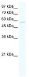 Zinc Finger Protein 559 antibody, TA341415, Origene, Western Blot image 