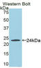 Fas Associated Via Death Domain antibody, LS-C728359, Lifespan Biosciences, Western Blot image 