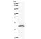 DExH-Box Helicase 9 antibody, LS-C342531, Lifespan Biosciences, Western Blot image 