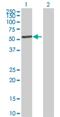 Inositol Hexakisphosphate Kinase 2 antibody, H00051447-B01P, Novus Biologicals, Western Blot image 