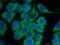 Checkpoint Kinase 2 antibody, 13954-1-AP, Proteintech Group, Immunofluorescence image 