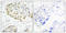 Signal Transducer And Activator Of Transcription 5A antibody, LS-C199613, Lifespan Biosciences, Immunohistochemistry paraffin image 