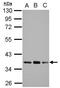 Pyruvate Dehydrogenase E1 Beta Subunit antibody, GTX119625, GeneTex, Western Blot image 