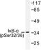 NFKB Inhibitor Alpha antibody, LS-C177916, Lifespan Biosciences, Western Blot image 