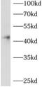 ArfGAP With Dual PH Domains 2 antibody, FNab00149, FineTest, Western Blot image 