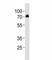 Dopamine Beta-Hydroxylase antibody, F52766-0.4ML, NSJ Bioreagents, Western Blot image 