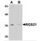 Regulator Of G Protein Signaling 21 antibody, TA306792, Origene, Western Blot image 