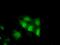 Tetratricopeptide Repeat Domain 32 antibody, MA5-25156, Invitrogen Antibodies, Immunocytochemistry image 