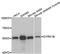 Dual specificity tyrosine-phosphorylation-regulated kinase 1B antibody, STJ23455, St John