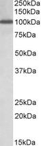 GPRIN Family Member 3 antibody, orb20628, Biorbyt, Western Blot image 