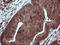 Mitogen-Activated Protein Kinase Kinase 1 antibody, LS-C174505, Lifespan Biosciences, Immunohistochemistry paraffin image 