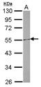 Cholesteryl Ester Transfer Protein antibody, NBP2-15867, Novus Biologicals, Western Blot image 