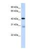 GRAM Domain Containing 2A antibody, NBP1-80540, Novus Biologicals, Western Blot image 