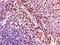 Acyl-CoA Dehydrogenase Family Member 8 antibody, LS-C398286, Lifespan Biosciences, Immunohistochemistry paraffin image 