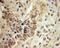 Mitochondrial Trans-2-Enoyl-CoA Reductase antibody, 51027-2-AP, Proteintech Group, Immunohistochemistry frozen image 