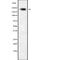 Kinesin Family Member 20B antibody, abx147103, Abbexa, Western Blot image 