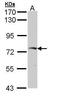Golgi Associated, Gamma Adaptin Ear Containing, ARF Binding Protein 2 antibody, GTX112213, GeneTex, Western Blot image 