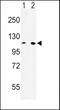 Microsomal Triglyceride Transfer Protein antibody, GTX80580, GeneTex, Western Blot image 