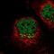 Interleukin 13 Receptor Subunit Alpha 1 antibody, NBP2-55120, Novus Biologicals, Immunocytochemistry image 