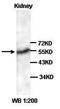 N-Acetyltransferase 1 antibody, orb77321, Biorbyt, Western Blot image 