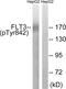 CD135 antibody, abx012600, Abbexa, Western Blot image 