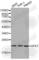 Glutathione Peroxidase 1 antibody, A1110, ABclonal Technology, Western Blot image 