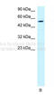 H2.0 Like Homeobox antibody, 31-201, ProSci, Enzyme Linked Immunosorbent Assay image 