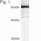 StAR Related Lipid Transfer Domain Containing 3 antibody, PA1-562, Invitrogen Antibodies, Western Blot image 