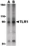 Toll Like Receptor 1 antibody, PA5-20182, Invitrogen Antibodies, Western Blot image 