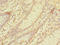 Solute Carrier Family 6 Member 3 antibody, LS-C378682, Lifespan Biosciences, Immunohistochemistry paraffin image 