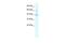Potassium Channel Tetramerization Domain Containing 10 antibody, PA5-41064, Invitrogen Antibodies, Western Blot image 