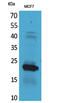 Interferon Lambda 2 antibody, STJ96670, St John