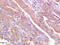 Mucin 1, Cell Surface Associated antibody, 251607, Abbiotec, Immunohistochemistry paraffin image 