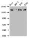 Histone Deacetylase 9 antibody, CSB-RA010245A0HU, Cusabio, Western Blot image 